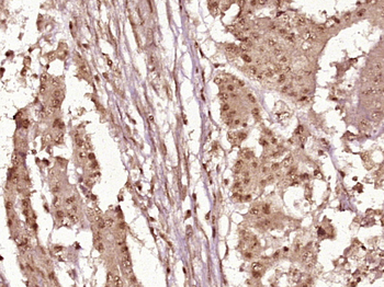 Phospho-LYRIC (Ser568) Rabbit Polyclonal Antibody