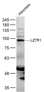 LZTR1 Rabbit Polyclonal Antibody