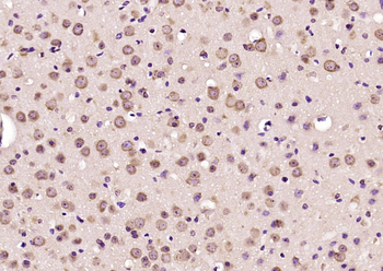 MRP63 Rabbit Polyclonal Antibody