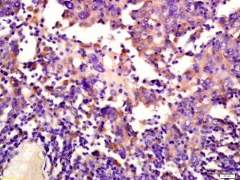 MMP13 Rabbit Polyclonal Antibody