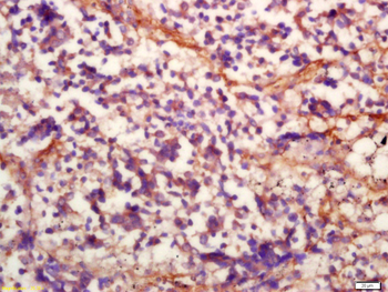 MMP13 Rabbit Polyclonal Antibody