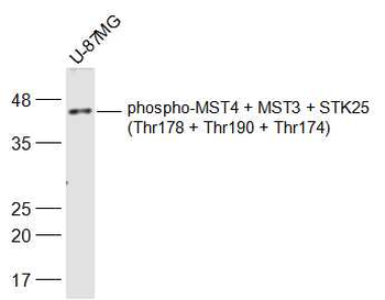 Phospho-MST4 + MST3 + STK25 (Thr178 + Thr190 + Thr174) Rabbit Polyclonal Antibody
