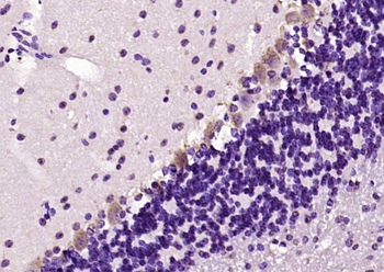 Phospho-MST4 (Thr190) Rabbit Polyclonal Antibody