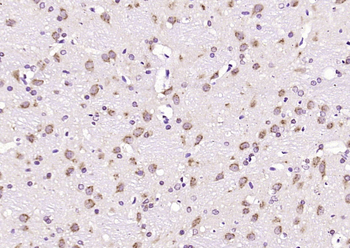 Phospho-MST3 (Thr178) Rabbit Polyclonal Antibody