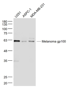 Melanoma gp100 Rabbit Polyclonal Antibody