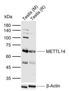 METTL14 Rabbit Polyclonal Antibody