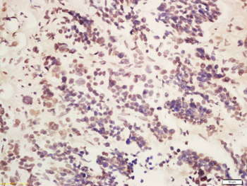 METTL14 Rabbit Polyclonal Antibody