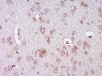 MMRN2 Rabbit Polyclonal Antibody