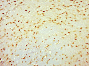Meningioma 1/MN1 Rabbit Polyclonal Antibody