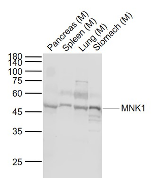MNK1 Rabbit Polyclonal Antibody