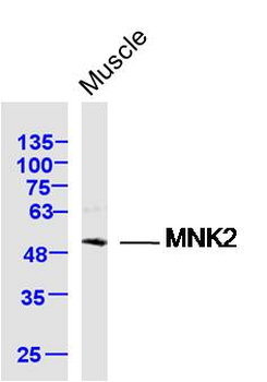 MNK2 Rabbit Polyclonal Antibody