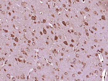 MOBKL2A Rabbit Polyclonal Antibody