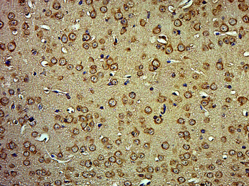 MORN4/C10orf83 Rabbit Polyclonal Antibody