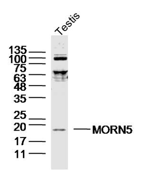 MORN5 Rabbit Polyclonal Antibody