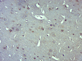 MRPL10 Rabbit Polyclonal Antibody