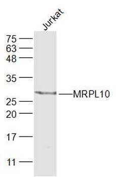 MRPL10 Rabbit Polyclonal Antibody