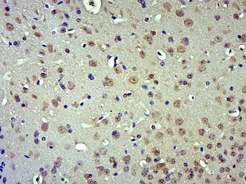 MRPL14 Rabbit Polyclonal Antibody