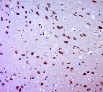 MRPL45 Rabbit Polyclonal Antibody