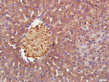 MRS2 Rabbit Polyclonal Antibody