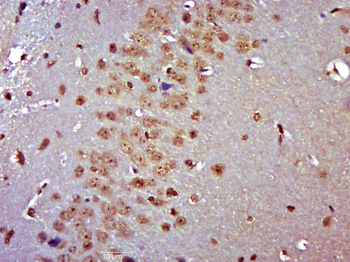 MSANTD2/C11orf61 Rabbit Polyclonal Antibody