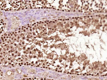 MSH4 Rabbit Polyclonal Antibody