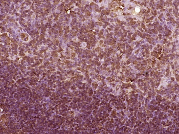 MSH5 Rabbit Polyclonal Antibody