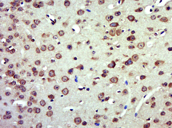 MTFMT Rabbit Polyclonal Antibody
