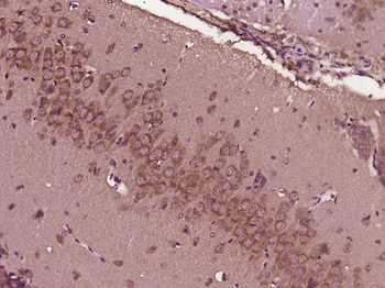 MTMR12 Rabbit Polyclonal Antibody