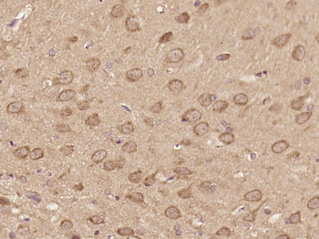 MTR Rabbit Polyclonal Antibody