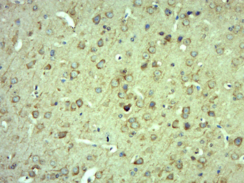 MTUS2 Rabbit Polyclonal Antibody