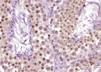 MYST1/KAT8 Rabbit Polyclonal Antibody