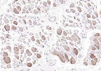 MYL2 Rabbit Polyclonal Antibody