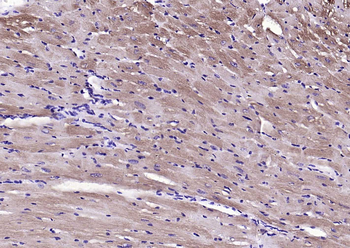 MYL2 Rabbit Polyclonal Antibody