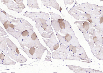 MYL2 Rabbit Polyclonal Antibody