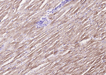MYL2 Rabbit Polyclonal Antibody