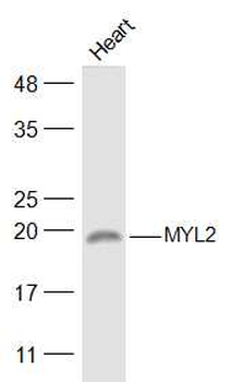 MYL2 Rabbit Polyclonal Antibody