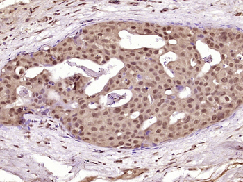 MACROD1 Rabbit Polyclonal Antibody