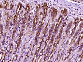 MAGT1 Rabbit Polyclonal Antibody