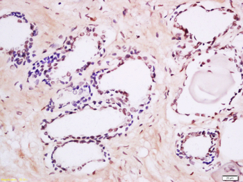 Phospho-MAK (Tyr159) Rabbit Polyclonal Antibody