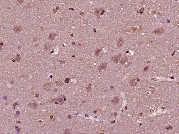 MAK3/C14orf35 Rabbit Polyclonal Antibody