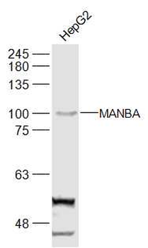 MANBA Rabbit Polyclonal Antibody