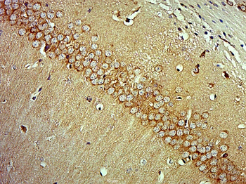 MAP3K13/LZK Rabbit Polyclonal Antibody