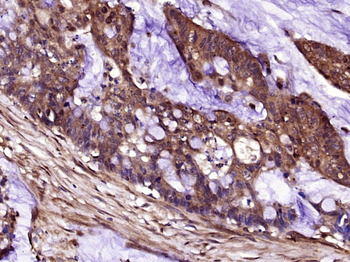 Marapsin1/CAPH2 Rabbit Polyclonal Antibody