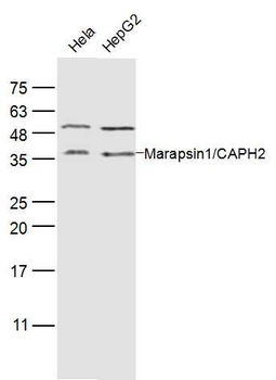 Marapsin1/CAPH2 Rabbit Polyclonal Antibody