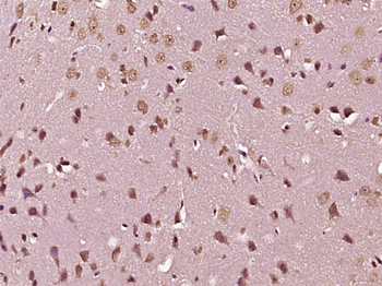 MAST3 Rabbit Polyclonal Antibody