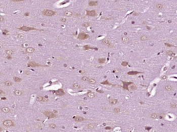 MAST3 Rabbit Polyclonal Antibody