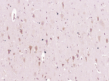 Matrilin 2 Rabbit Polyclonal Antibody