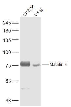 Matrilin 4 Rabbit Polyclonal Antibody