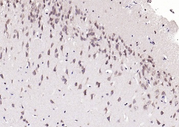 MCL1 (phospho-Ser159) antibody