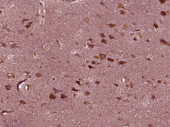 ME3 Rabbit Polyclonal Antibody